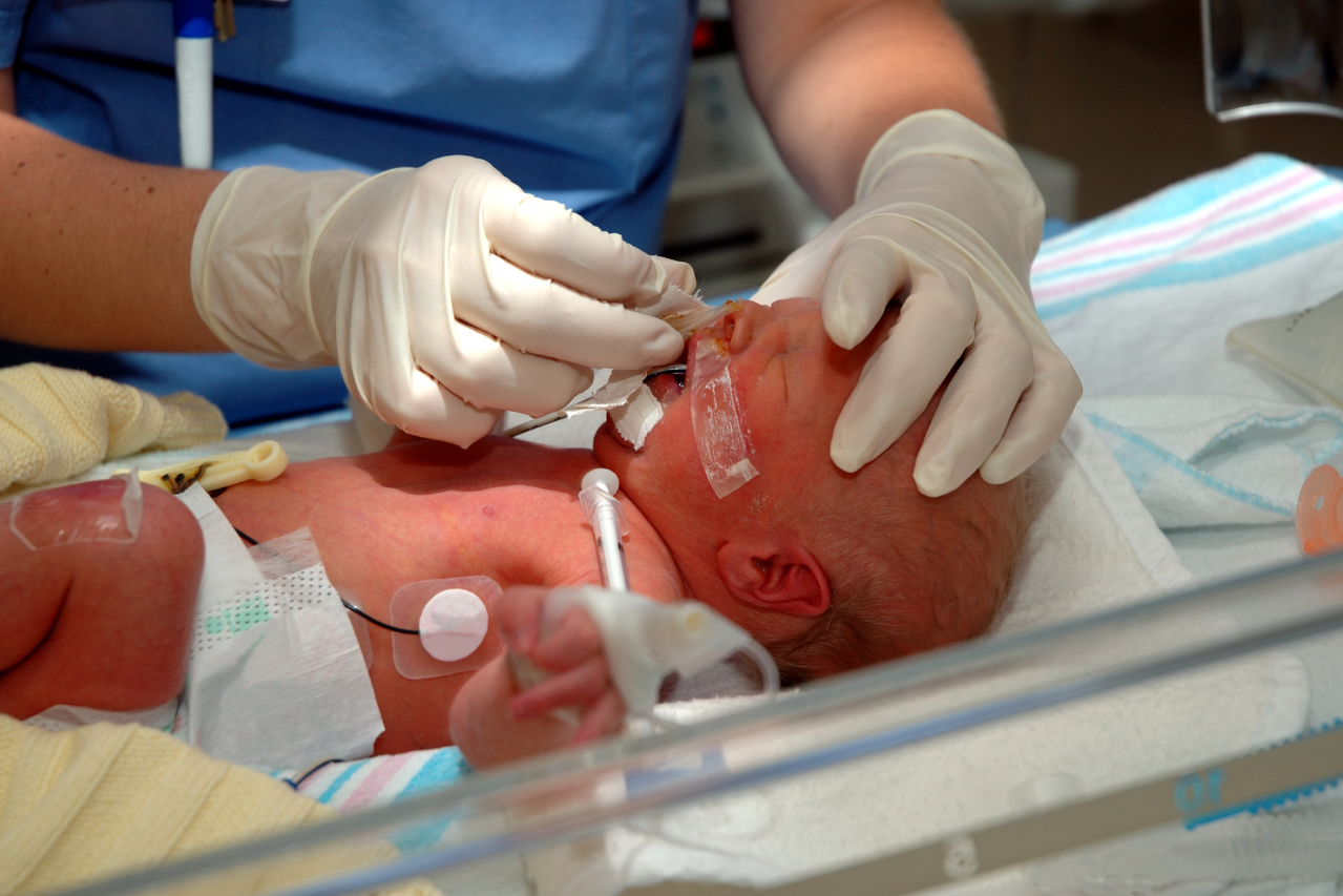 AI in Neonatal Care: Predictive Analytics and Early Detection Saving Lives